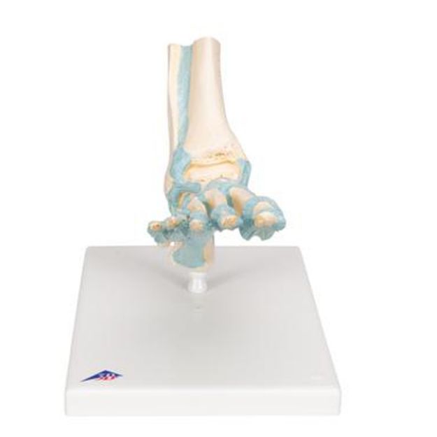 Afbeeldingen van Voet met ligamenten